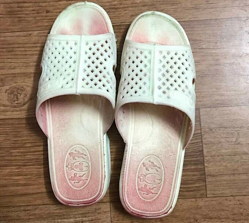 Mồ hôi máu là gì? Nguyên nhân và triệu chứng 2