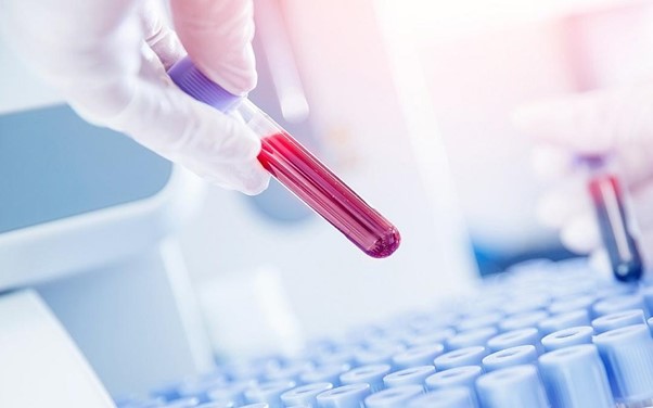 Xét nghiệm progesterone là gì? Tại sao cần làm xét nghiệm progesterone?+5