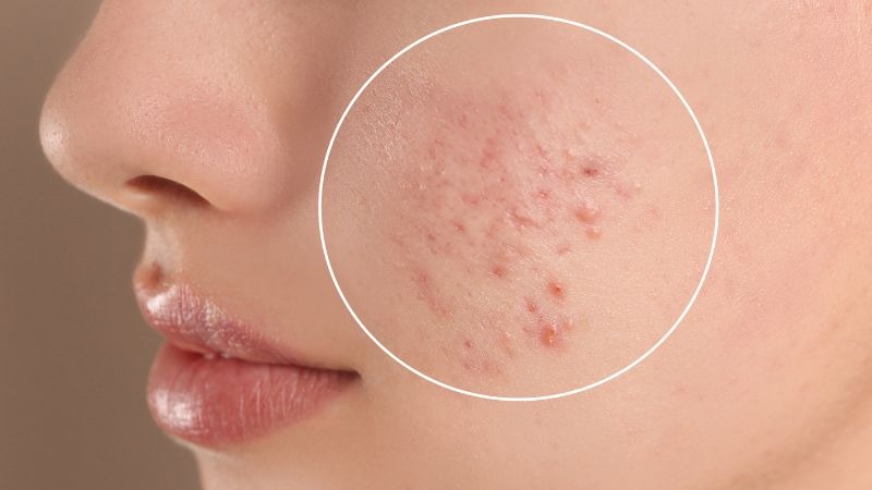 6 biểu hiện dễ nhìn thấy ở da cho biết bạn đang thiếu vitamin 2