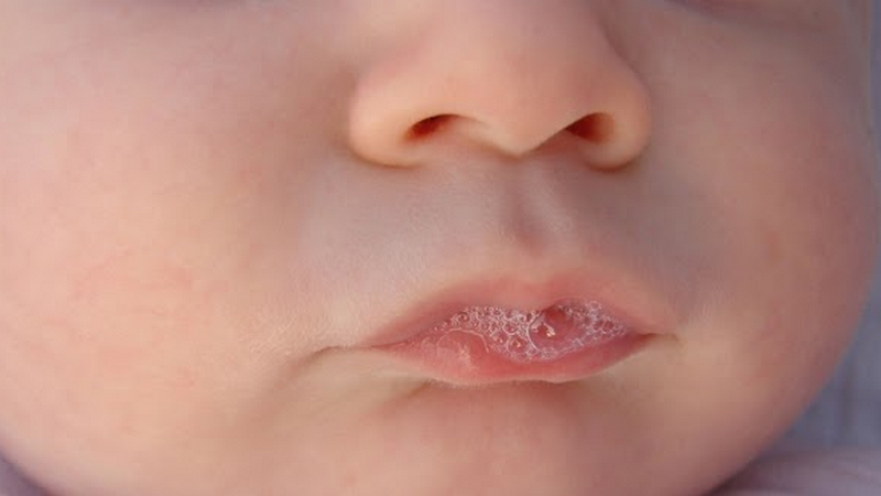 Bé phun mưa trong thời gian ăn dặm: Nguyên nhân và cách xử lý cho các mẹ 1