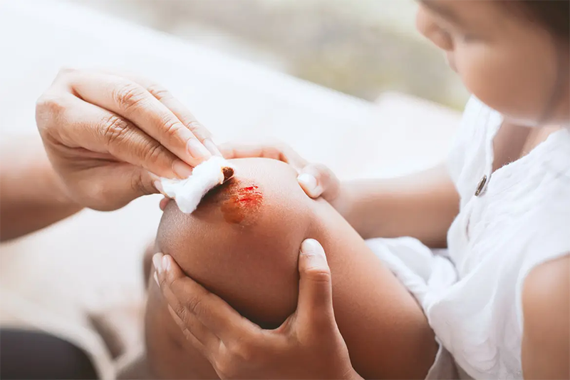 Bị vết thương hở có ăn được thịt ngan không? 1