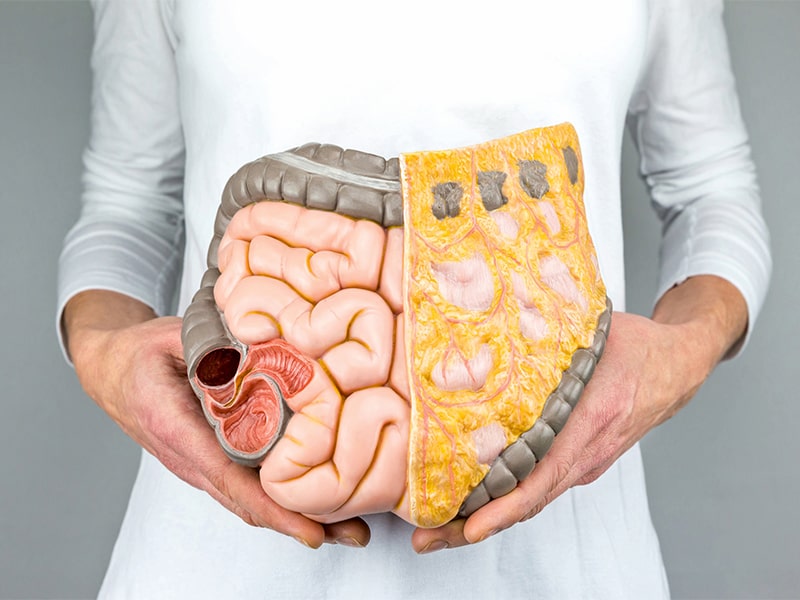 Mỡ nội tạng là gì? Cách xác định chỉ số mỡ nội tạng của nữ giới và nam giới 3