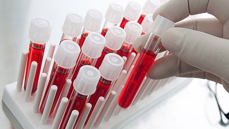 Chảy dịch mũi sau: Nguyên nhân, biểu hiện và cách điều trị hiệu quả 4