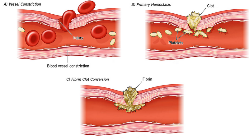 Chảy máu lâu cầm: Nguyên nhân và cách xử lý hiệu quả 1