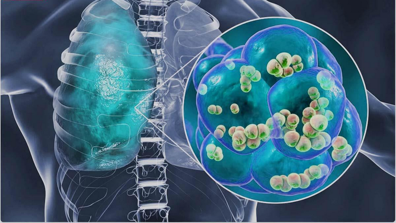 Có cần thiết phải tiêm phế cầu cho trẻ không? Có xuất hiện phản ứng phụ sau tiêm không? 1