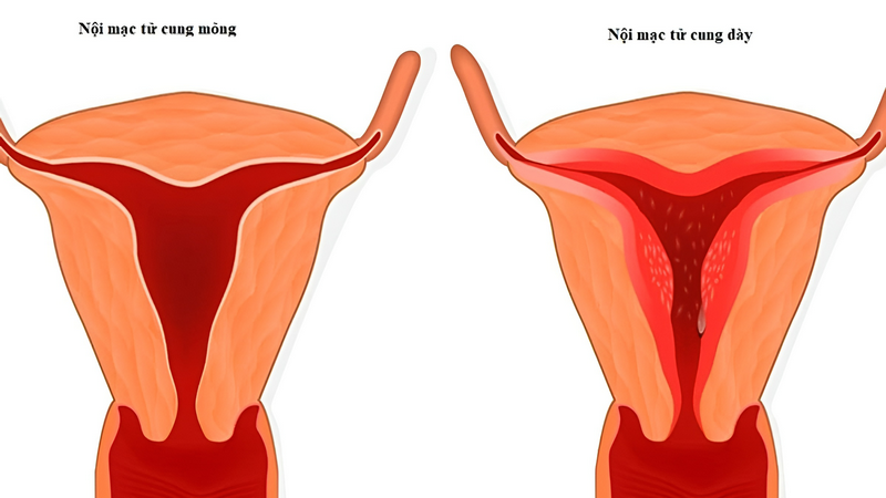 Có phải uống nước cam làm mỏng niêm mạc không? 2