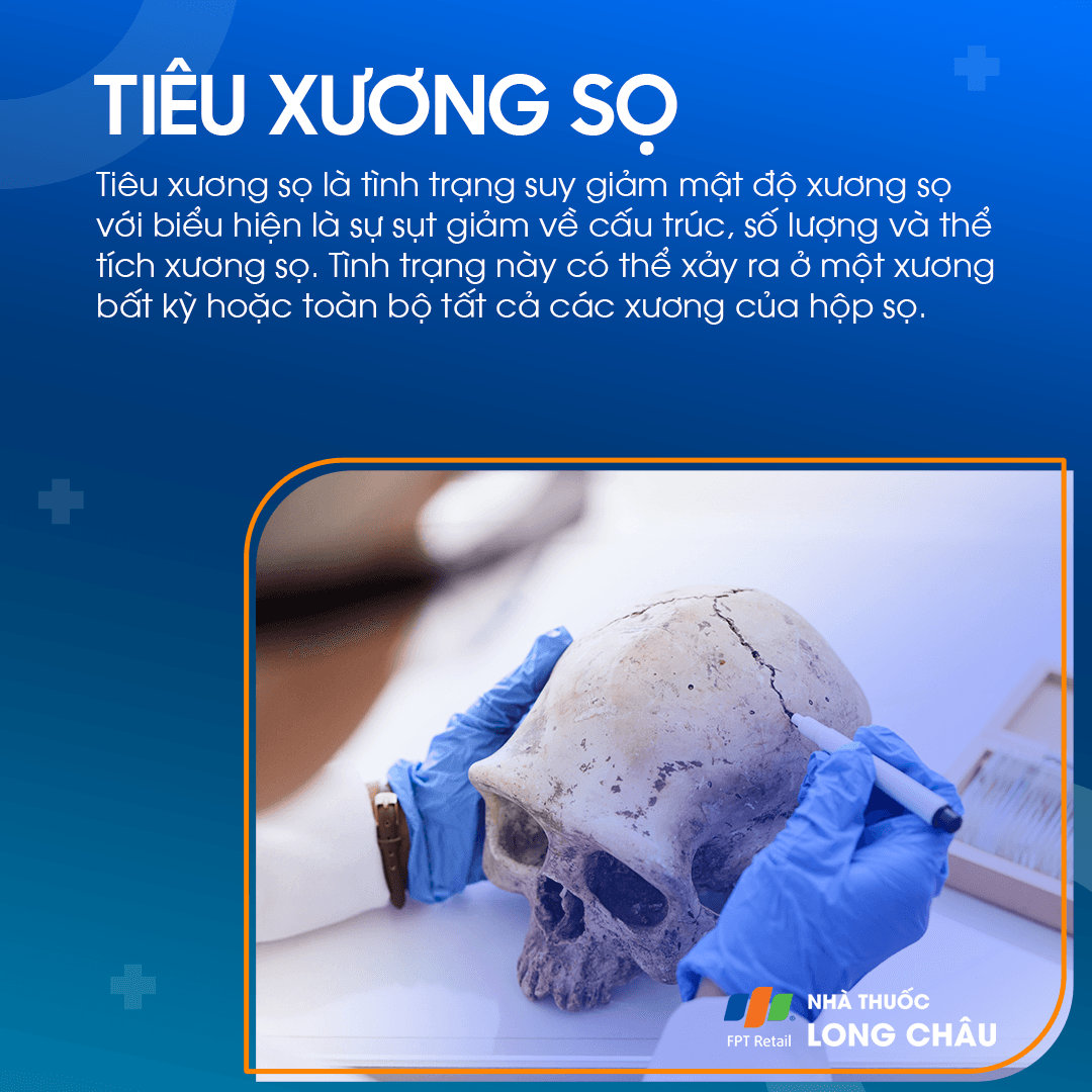Tiêu xương sọ là gì? Nguyên nhân, triệu chứng và cách điều trị