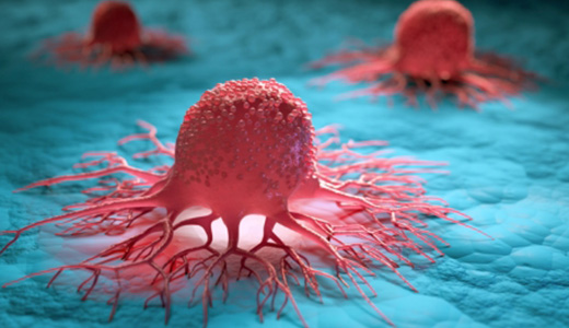 Dấu ấn khối u 02