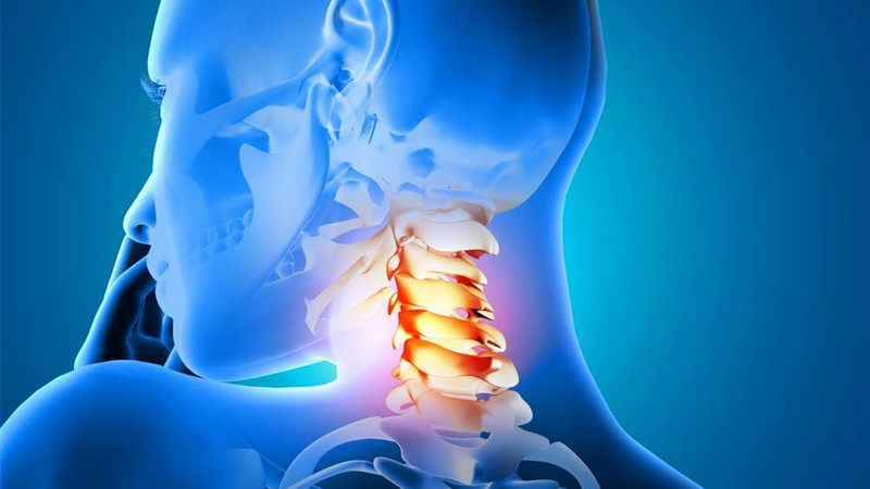 Đau dây thần kinh ở cổ có nguy hiểm không? Dấu hiệu, nguyên nhân và cách phòng ngừa. 3