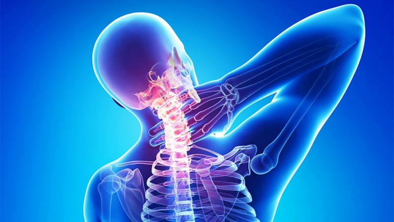 Đau dây thần kinh ở cổ có nguy hiểm không? Dấu hiệu, nguyên nhân và cách phòng ngừa. 4