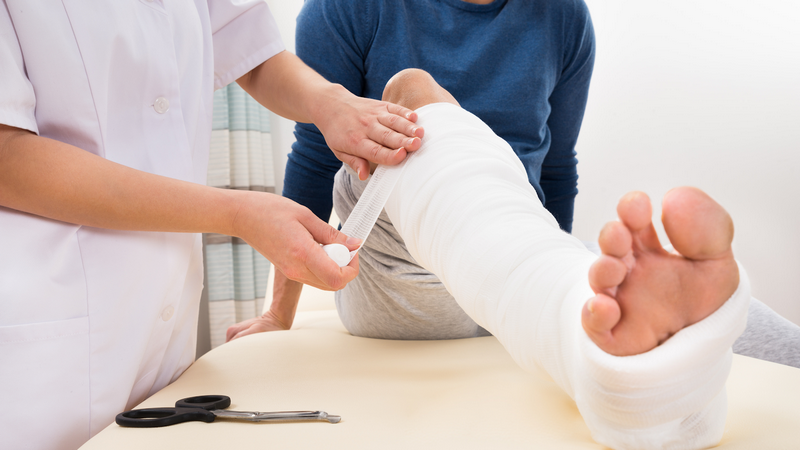 Gãy 1/3 dưới xương chày 6