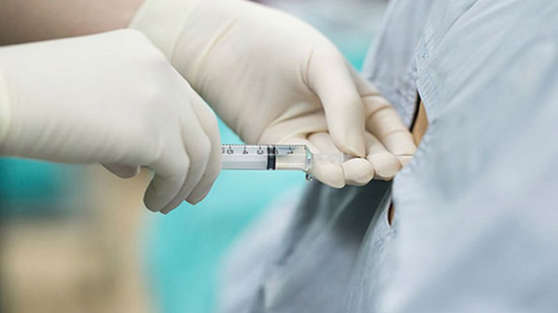 Gây mê là gì? Các kỹ thuật gây mê hiệu quả nhất 2