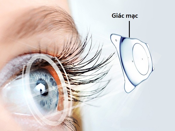 Giác mạc 02