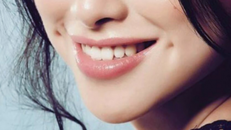 Giải đáp từ chuyên gia thẩm mỹ: Tạo má lúm có để lại sẹo không? 2