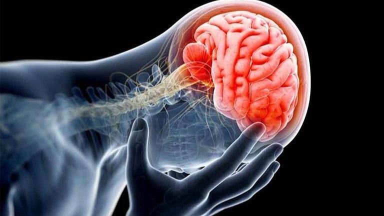 Hội chứng giao bên: Nguyên nhân, Triệu chứng, Chẩn đoán 1