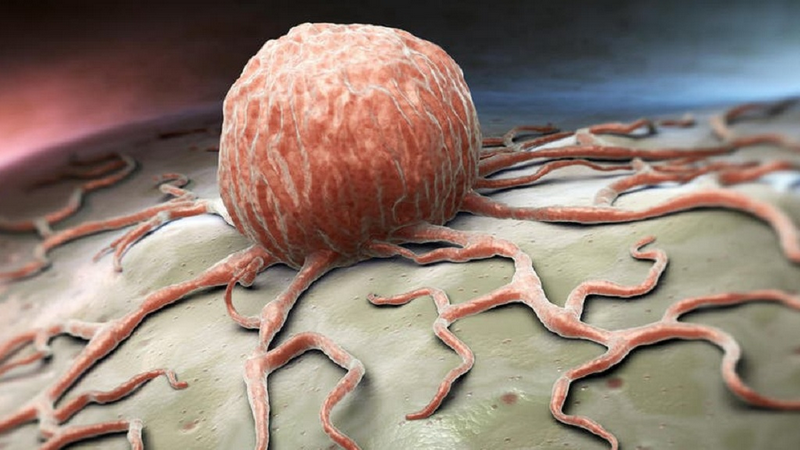 Khô da sắc tố - Dấu hiệu, nguyên nhân và cách điều trị 2