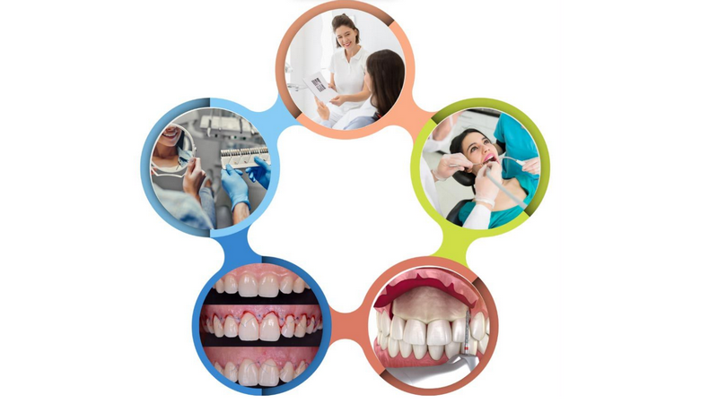 Mài gồ xương ô răng: Giải pháp điều trị răng hô và cười hở lợi hiệu quả 1