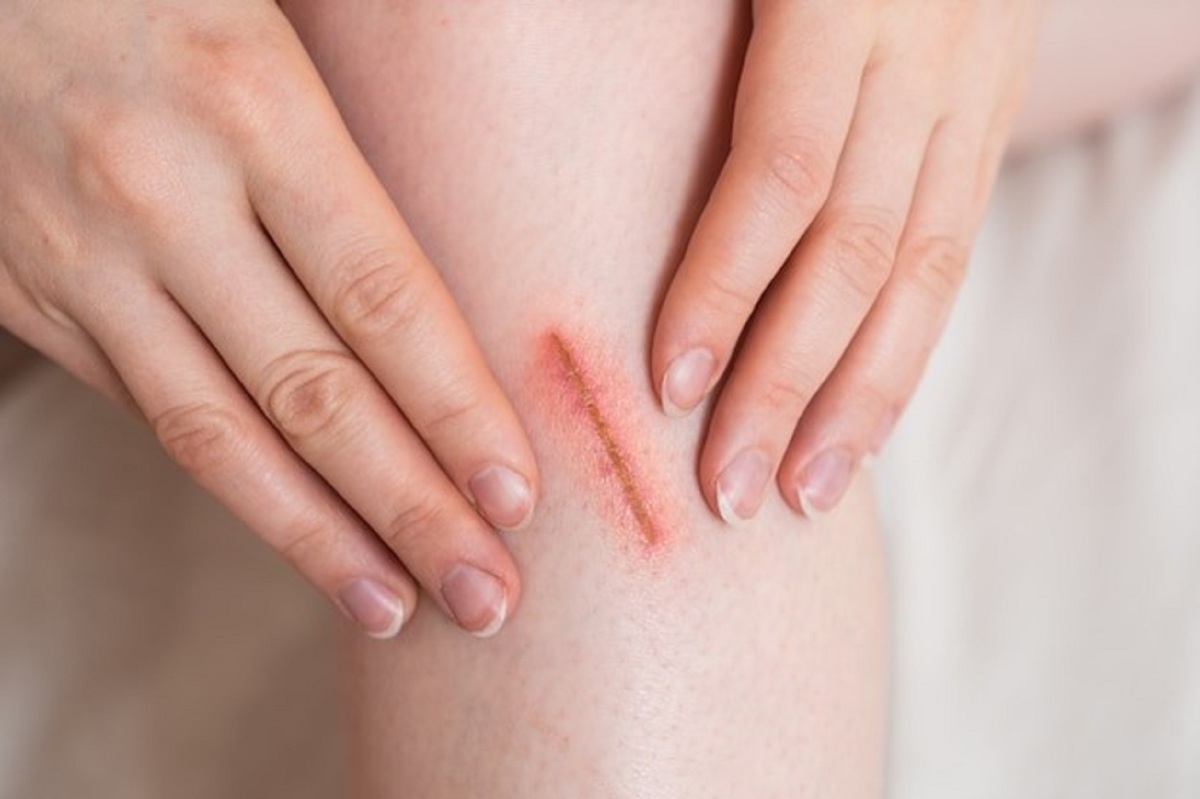 Mallow là gì? Công dụng của Mallow trong mỹ phẩm 3