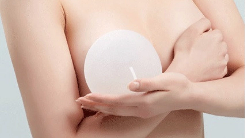 Nâng ngực bao lâu được mang thai? Những điều cần biết để đảm bảo an toàn cho mẹ và bé 2