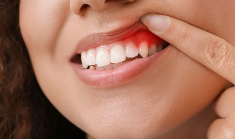 Nên khám răng định kỳ bao lâu một lần? Giải thích đầy đủ 2