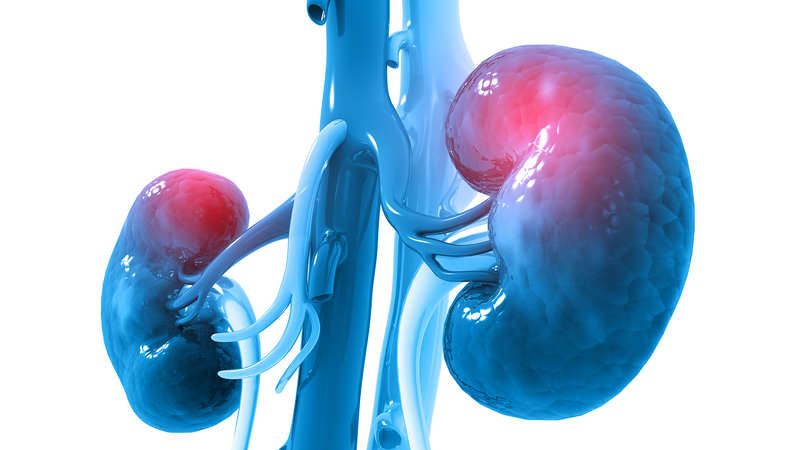 Nhận biết sớm các dấu hiệu suy thận giai đoạn đầu và phòng ngừa kịp thời 1
