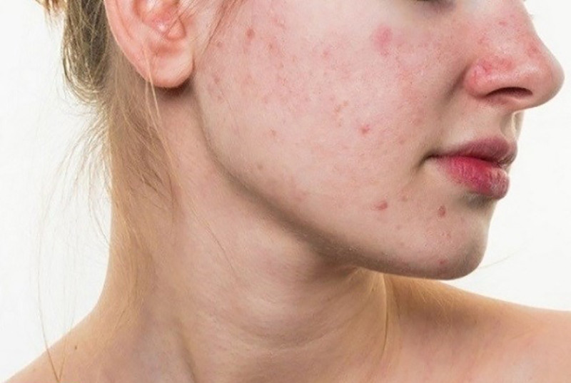 Octinoxate là gì? Công dụng của Octinoxate trong mỹ phẩm chăm sóc da.2