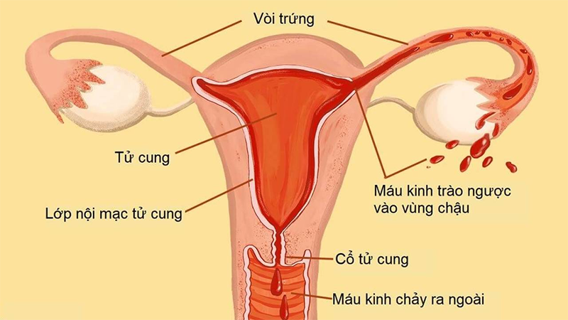 Quan hệ có ảnh hưởng đến niêm mạc tử cung 1