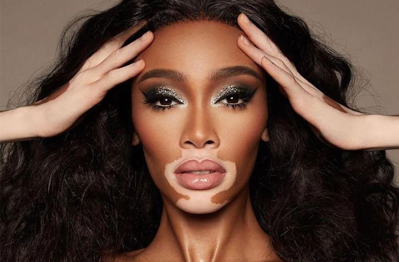 Rối loạn sắc tố da là gì? Làm cách nào điều trị rối loạn sắc tố da? 3