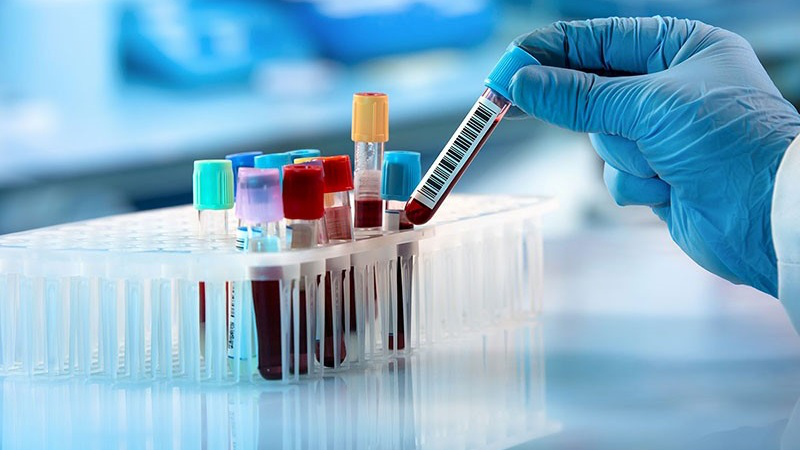 Rubella IgG dương tính: Chỉ số bao nhiêu là bình thường? 3