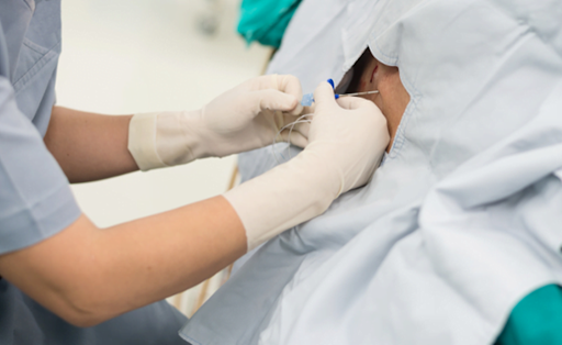 Thủ thuật chọc dịch não tủy an toàn và rủi ro 2.png