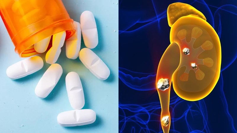 Thuốc giãn cơ trơn niệu quản: Hướng dẫn sử dụng 1