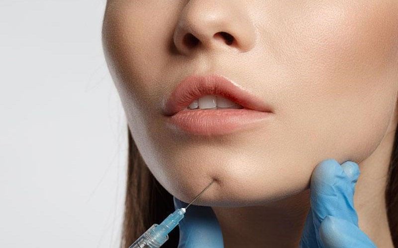 Tiêm tan filler cần kiêng gì? Nên ăn gì để hồi phục nhanh? `