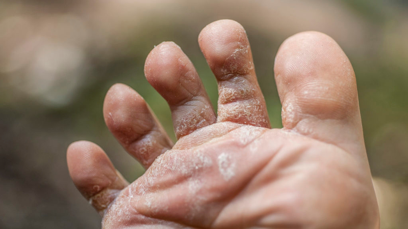 Tiểu đường giai đoạn đầu có chữa được không? Giải thích chi tiết 2