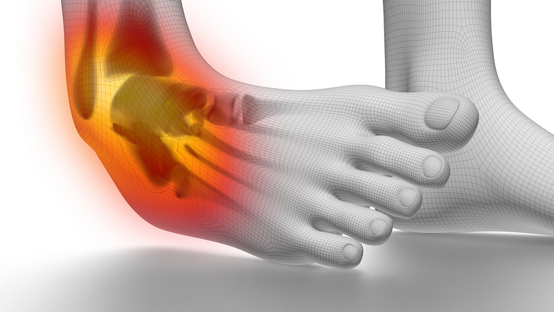 Trật khớp cổ chân: Dấu hiệu, nguyên nhân và cách điều trị 1