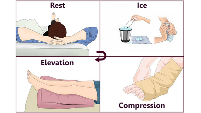 Trật khớp cổ chân: Dấu hiệu, nguyên nhân và cách điều trị 4