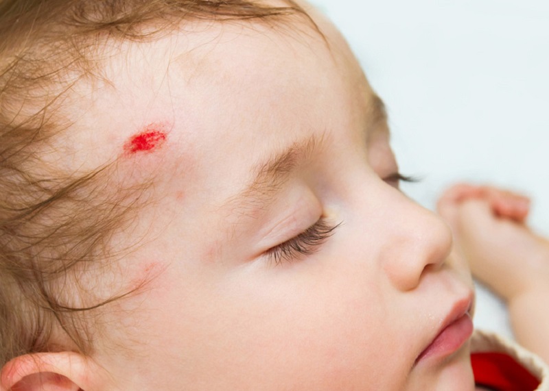 tre-em-bi-nga-sung-dau-co-nen-boi-dau-gio 2