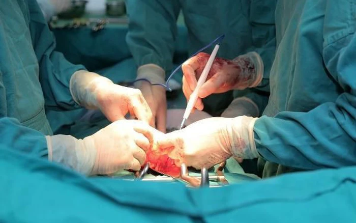 Ung thư thực quản di căn xương: Dấu hiệu, nguyên nhân và cách điều trị 3