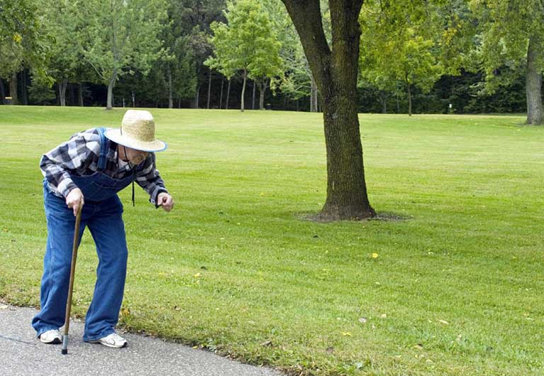 Xẹp đốt sống là gì? Những vấn đề cần biết về xẹp đốt sống 1