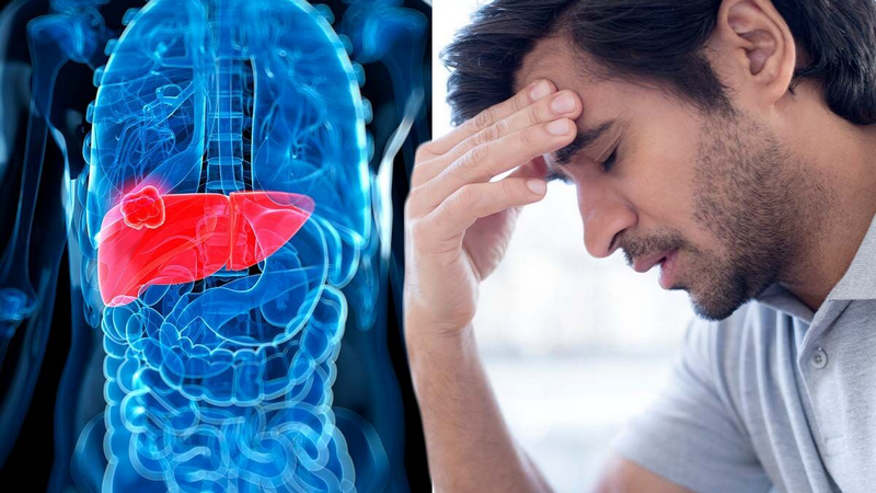 Vỡ tĩnh mạch thực quản - biến chứng nghiêm trọng từ xơ gan 4