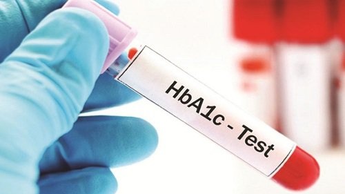 Xét nghiệm HbA1c có cần nhịn ăn?