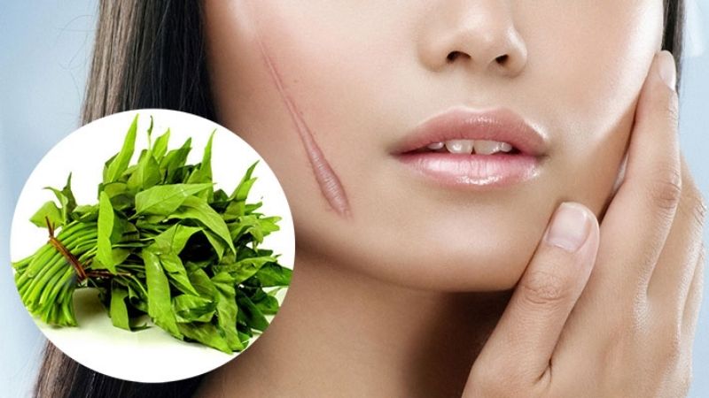 Ăn mì tôm có bị sẹo lồi không? Thực phẩm không nên ăn khi bị vết thương 3