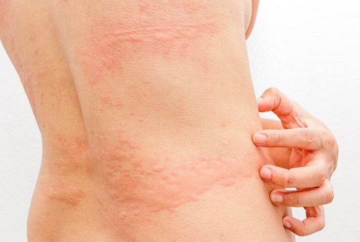 Sán trong thịt heo chết ở bao nhiêu độ C? Cách nhận biết thịt lợn nhiễm sán 1