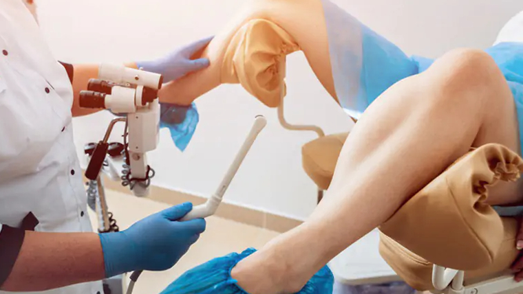 Áp lạnh cổ tử cung có sinh thường được không? 1