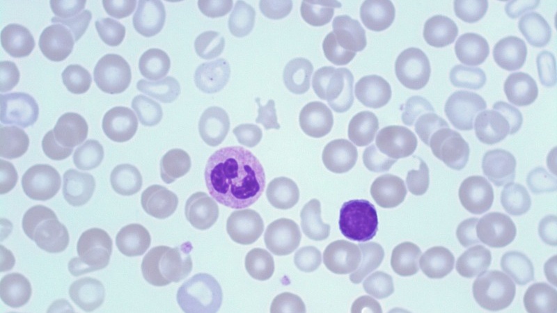 Bạch cầu lympho là gì? Dấu hiệu nhận biết bạch cầu lympho tăng