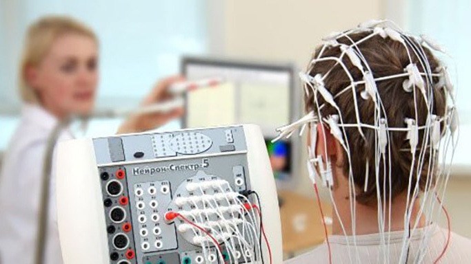 Bại não thể co cứng: Triệu chứng, chuẩn đoán và phương pháp điều trị 3