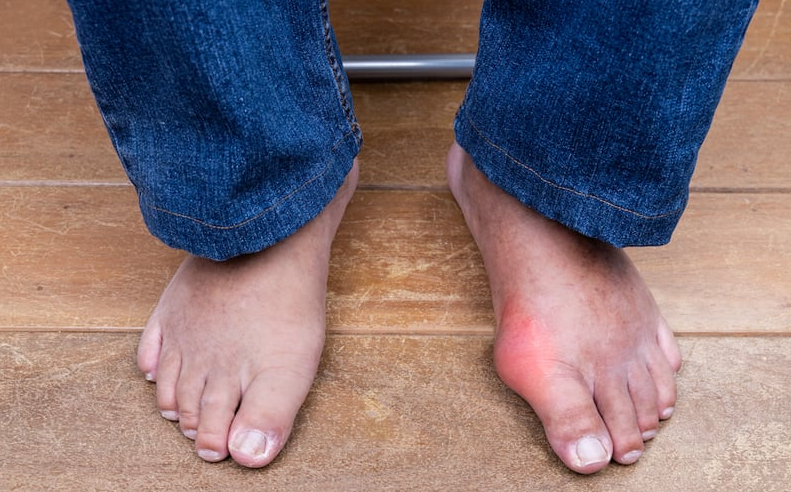 Ăn ốc bông có tác dụng gì? Ai không nên ăn ốc bông? 4