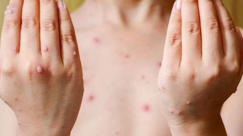 Ăn phao câu gà có tốt không? Đối tượng nào cần tránh? 3