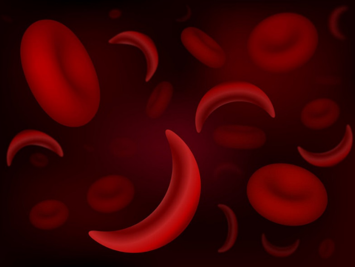 Bạch cầu trung tính tăng trong trường hợp nào? Cách chẩn đoán bệnh? 2