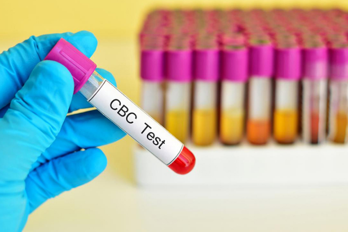 Bạch cầu trung tính tăng trong trường hợp nào? Cách chẩn đoán bệnh? 4