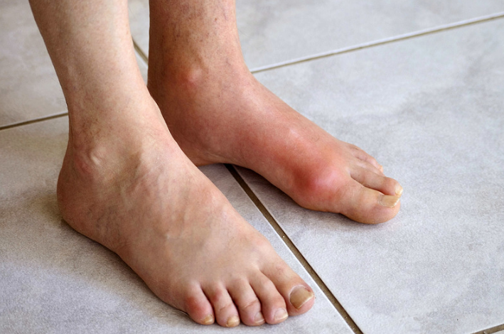 Các loại cua biển phổ biến ở Việt Nam và lợi ích khi ăn cua 5